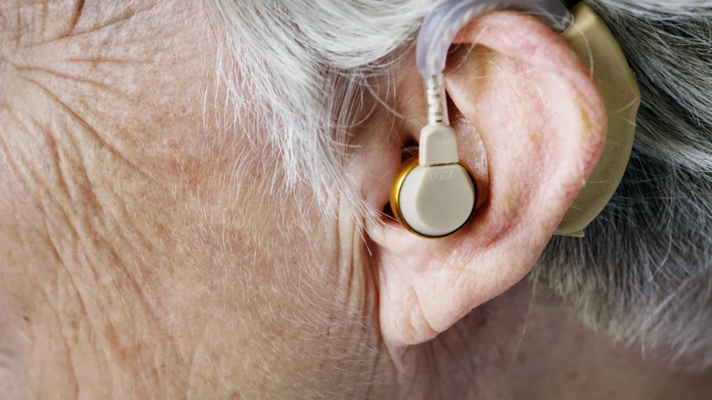Mujer mayor con audífono retroauricular, uno de los tipos de audífonos recomendados en la presbiacusia